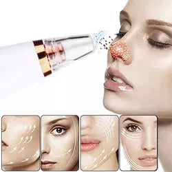 Succionador de Poros - GlowPore